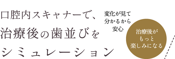 iTeroで、治療後の歯並びをシミュレーション